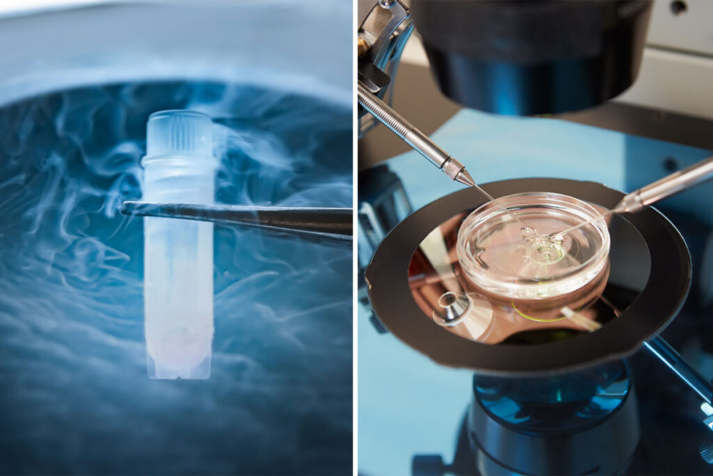Fresh IVF Cycle v Frozen Embryo Transfer Cycle