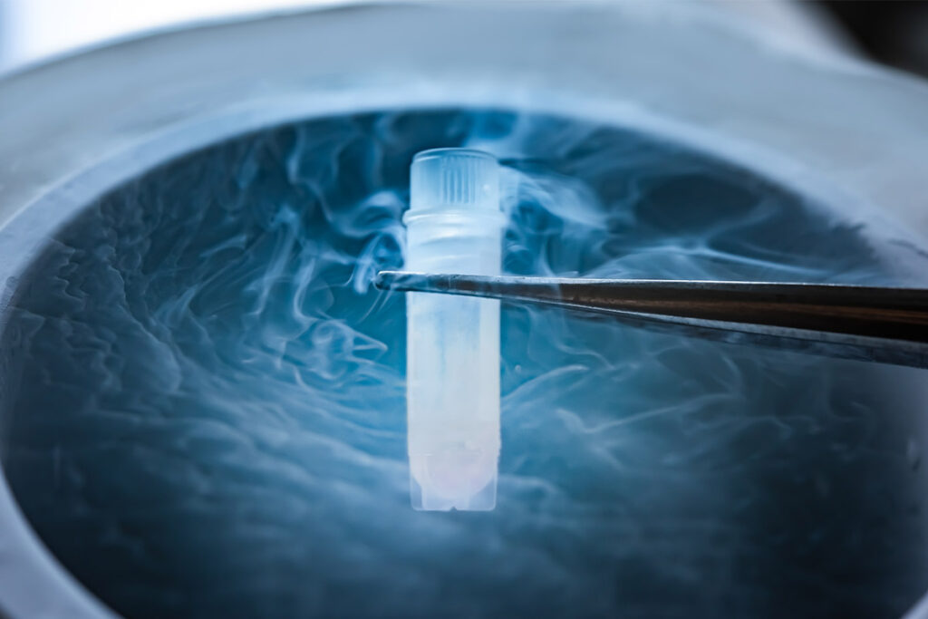 Frozen Embryo Transfer – what do you need to know