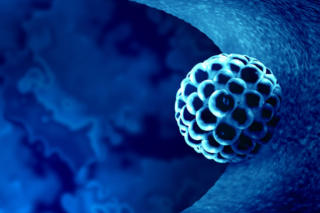 Failed Euploid Embryo Transfers: When Should We Worry?